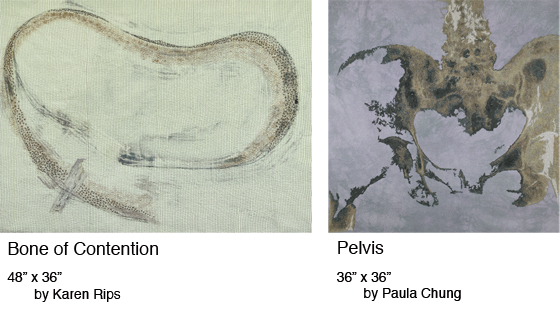 Step on a Crack - Slipped Disc