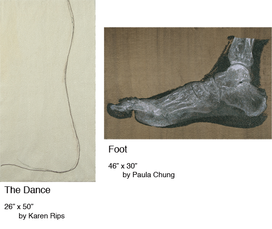 Step on a Crack - Slipped Disc