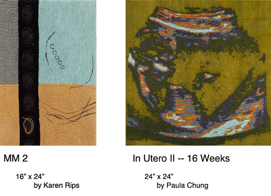MM 2/In Utero II 16 weeks