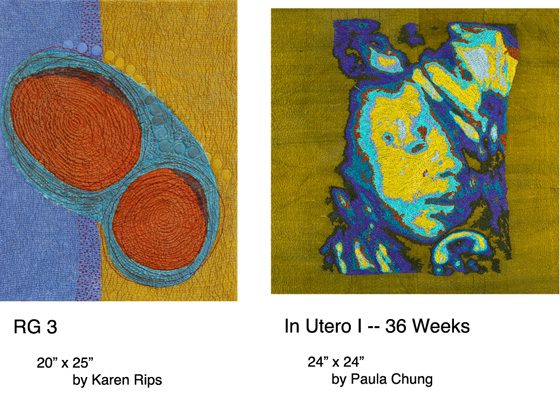 RG 3/In Utero I 36 weeks